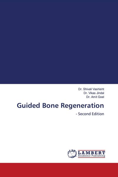 Produktbild: Guided Bone Regeneration