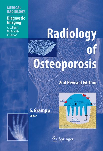 Produktbild: Radiology of Osteoporosis