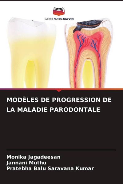 Produktbild: MOD&Egrave;LES DE PROGRESSION DE LA MALADIE PARODONTALE