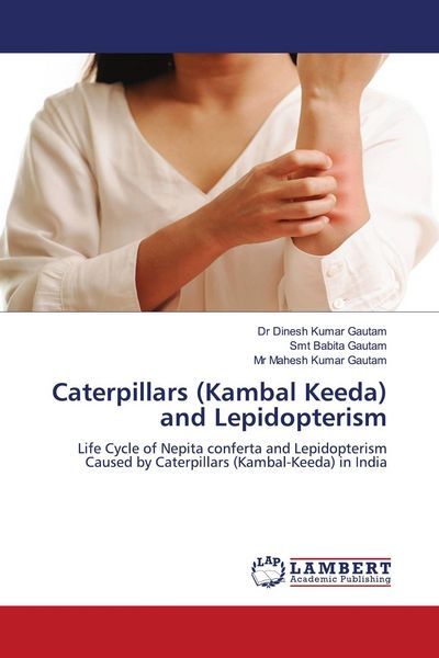 Produktbild: Caterpillars (Kambal Keeda) and Lepidopterism