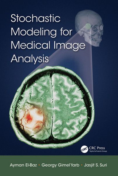 Produktbild: Stochastic Modeling for Medical Image Analysis
