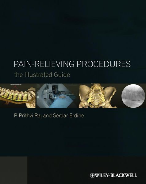 Produktbild: Pain-Relieving Procedures
