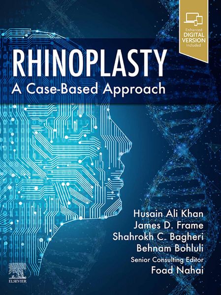 Produktbild: Rhinoplasty E-Book