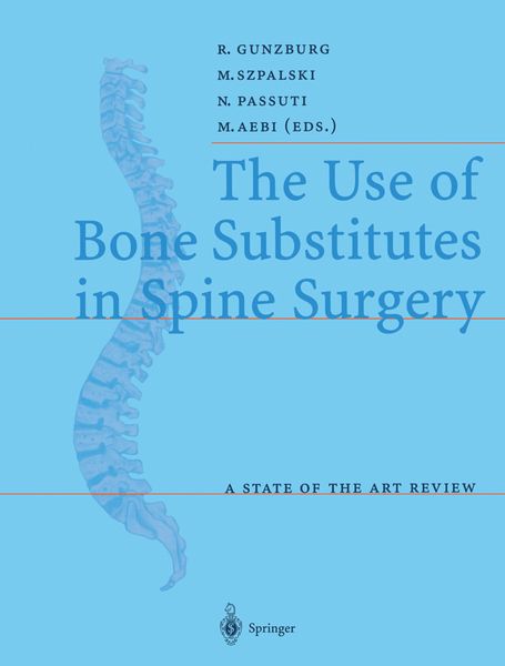 Produktbild: The Use of Bone Substitutes in Spine Surgery