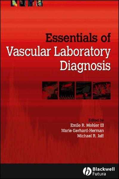 Produktbild: Essentials of Vascular Laboratory Diagnosis