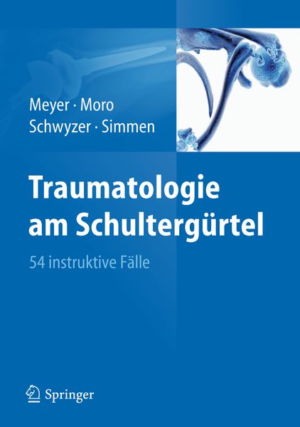 Produktbild: Traumatologie am Schulterg&uuml;rtel