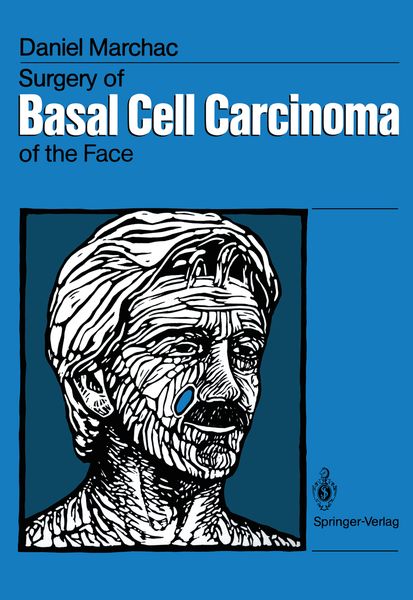 Produktbild: Surgery of Basal Cell Carcinoma of the Face