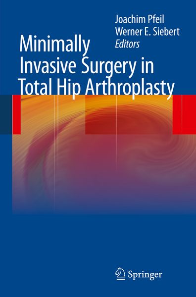 Produktbild: Minimally Invasive Surgery in Total Hip Arthroplasty