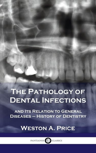 Produktbild: Pathology of Dental Infections