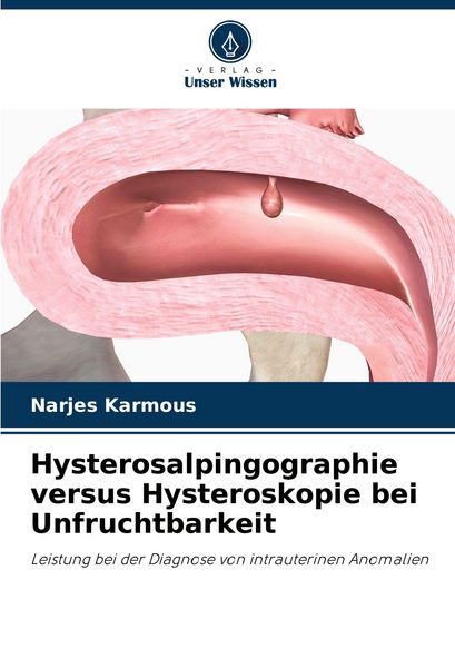 Produktbild: Hysterosalpingographie versus Hysteroskopie bei Unfruchtbarkeit