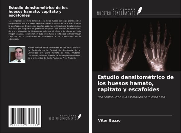 Produktbild: Estudio densitom&eacute;trico de los huesos hamato, capitato y escafoides