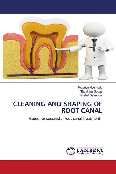 Produktbild: Cleaning and Shaping Of Root Canal