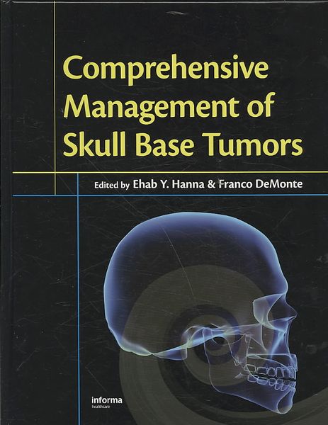 Produktbild: Hanna, E: Comprehensive Management of Skull Base Tumors