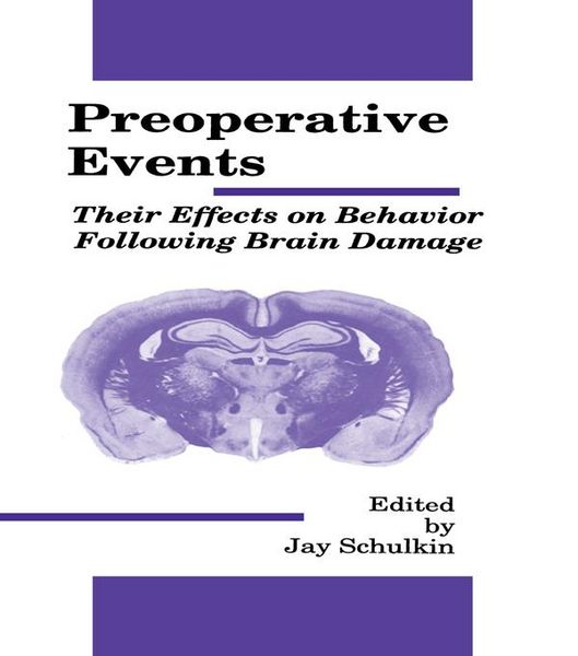 Produktbild: Preoperative Events