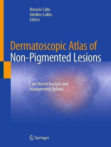 Produktbild: Dermatoscopic Atlas of Non-Pigmented Lesions