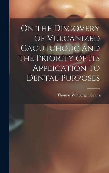 Produktbild: On the Discovery of Vulcanized Caoutchouc and the Priority of its Application to Dental Purposes