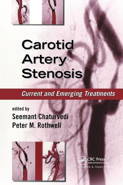 Produktbild: Carotid Artery Stenosis