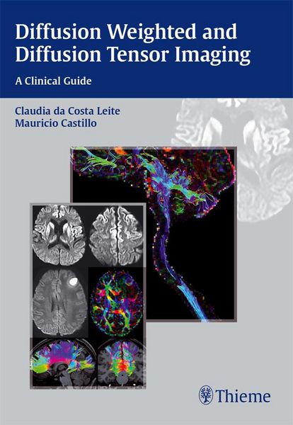 Produktbild: Diffusion Weighted and Diffusion Tensor Imaging