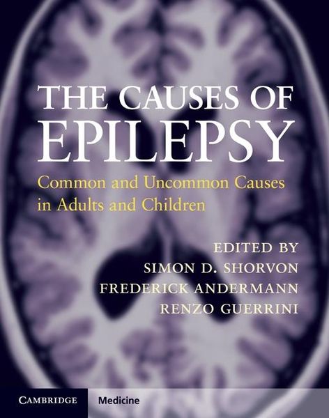 Produktbild: Causes of Epilepsy