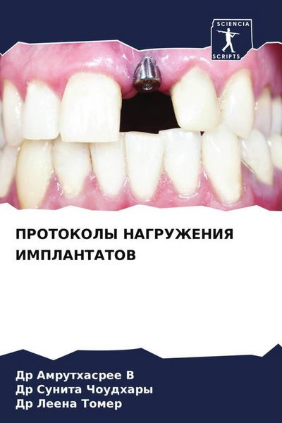 Produktbild: Protokoly Nagruzheniya Implantatov