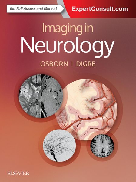 Produktbild: Imaging in Neurology E-Book