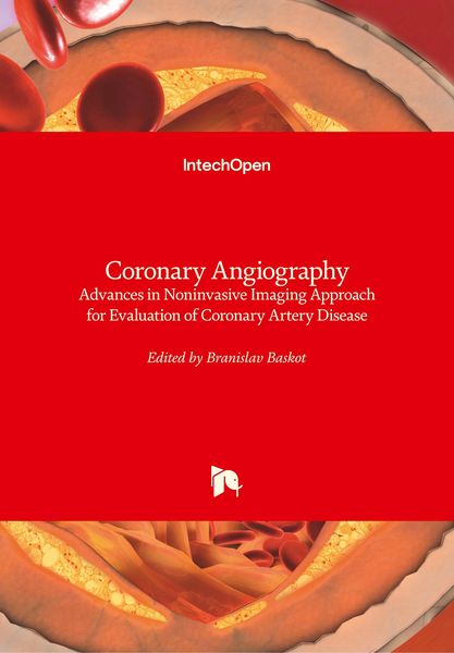 Produktbild: Coronary Angiography
