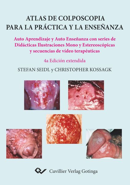Produktbild: Atlas de colposcopia para la pr&aacute;ctica y la ense&ntilde;anza
