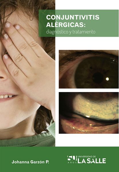 Produktbild: Conjuntivitis al&eacute;rgicas