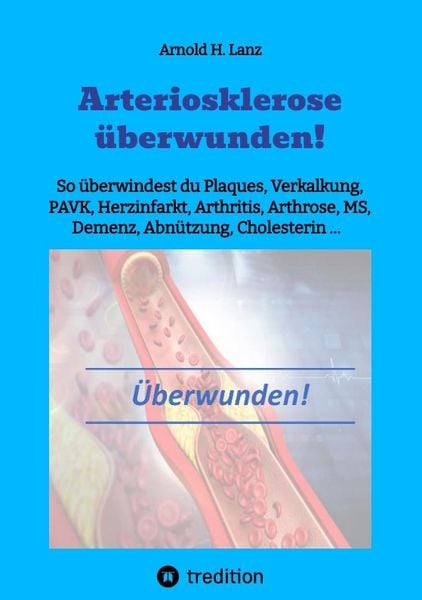 Produktbild: Arteriosklerose &uuml;berwunden!