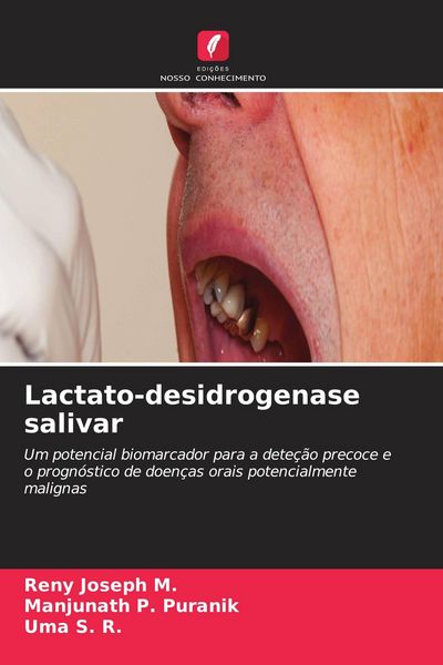 Produktbild: Lactato-desidrogenase salivar