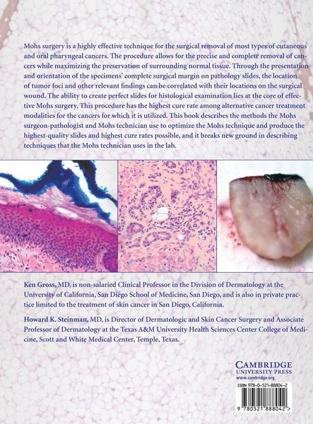 Produktbild: Mohs Surgery and Histopathology