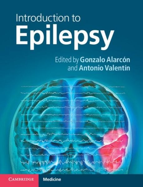Produktbild: Introduction to Epilepsy