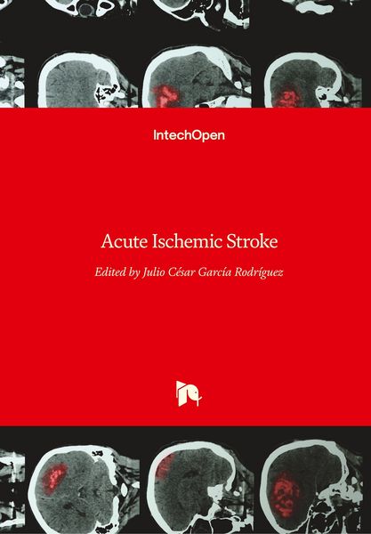 Produktbild: Acute Ischemic Stroke