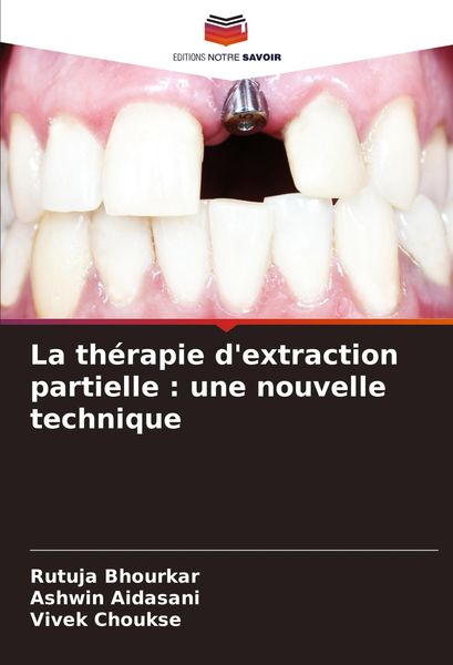Produktbild: La th&eacute;rapie d'extraction partielle : une nouvelle technique