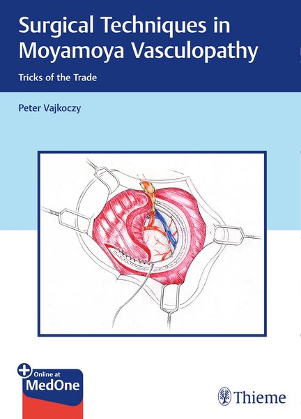 Produktbild: Surgical Techniques in Moyamoya Vasculopathy