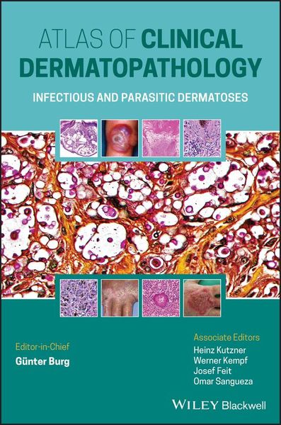 Produktbild: Atlas of Clinical Dermatopathology