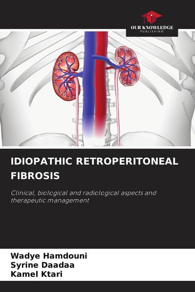 Produktbild: Idiopathic Retroperitoneal Fibrosis