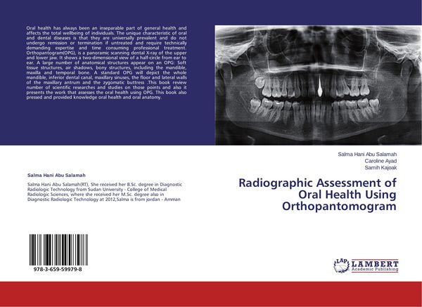 Produktbild: Radiographic Assessment of Oral Health Using Orthopantomogram