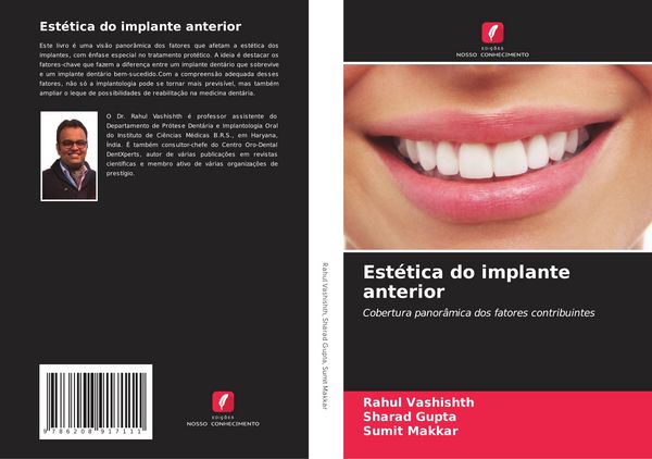 Produktbild: Est&eacute;tica do implante anterior