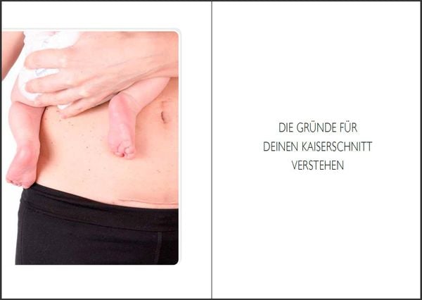 Produktbild: Nat&uuml;rliche Geburt nach Kaiserschnitt: Praxis-Wissen von der &Auml;rztin - Das VBAC-Buch, das deine n&auml;chste Schwangerschaft und Geburt vereinfacht