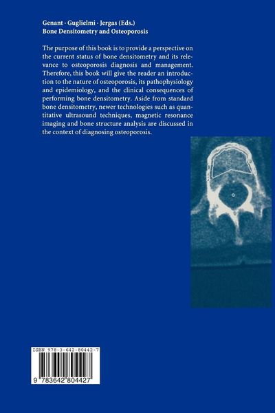 Produktbild: Bone Densitometry and Osteoporosis