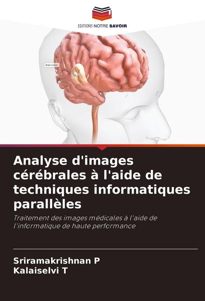 Produktbild: Analyse d'images c&eacute;r&eacute;brales &agrave; l'aide de techniques informatiques parall&egrave;les