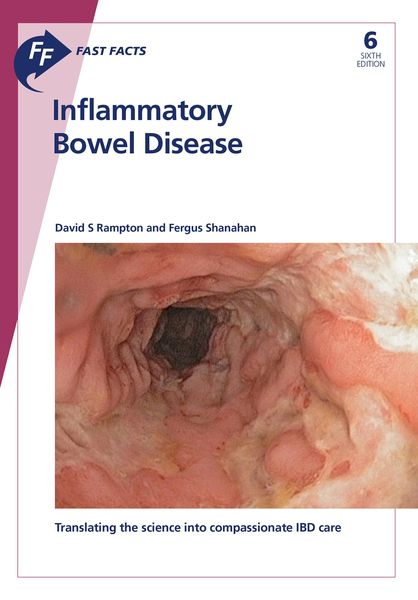 Produktbild: Fast Facts: Inflammatory Bowel Disease