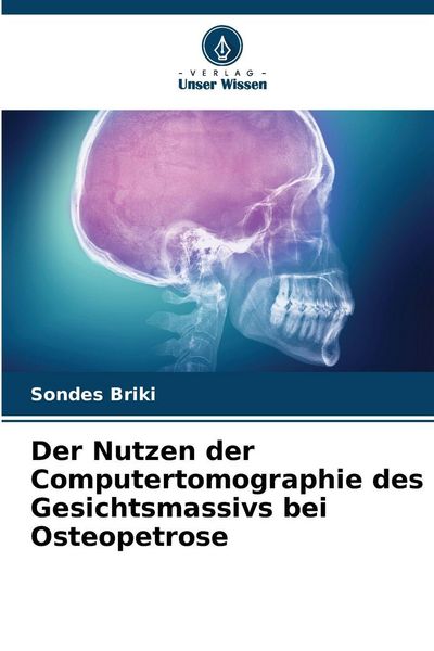 Der Nutzen der Computertomographie des Gesichtsmassivs bei Osteopetrose, Taschenbuch von Sondes Briki, Verlag Unser Wissen, 9786209102394