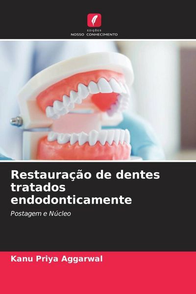 Produktbild: Restaura&ccedil;&atilde;o de dentes tratados endodonticamente