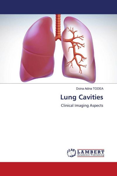 Produktbild: Lung Cavities