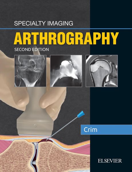 Produktbild: Specialty Imaging: Arthrography E-Book