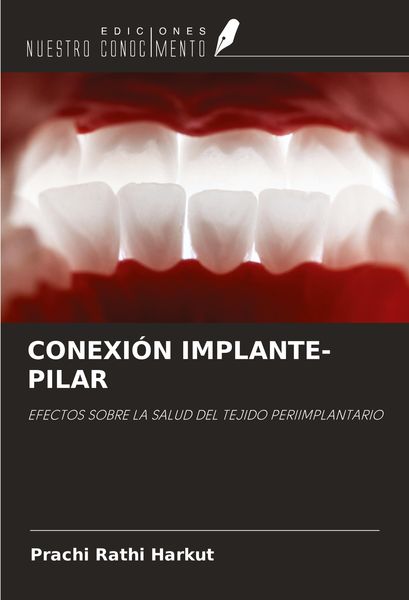 Produktbild: Conexi&oacute;n Implante-Pilar