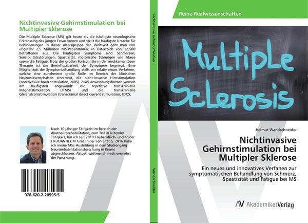 Produktbild: Nichtinvasive Gehirnstimulation bei Multipler Sklerose