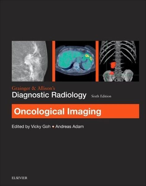 Produktbild: Grainger & Allison's Diagnostic Radiology: Oncological Imaging